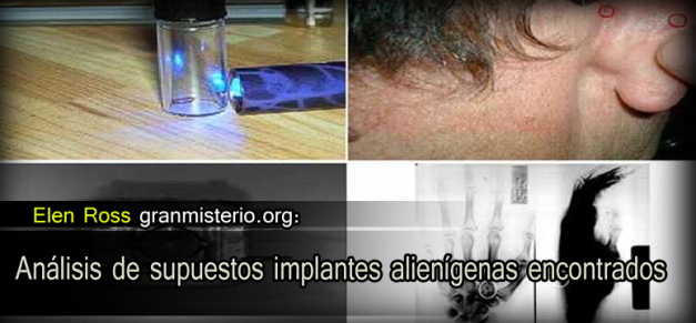 Análisis de supuestos implantes alienígenas encontrados Opl